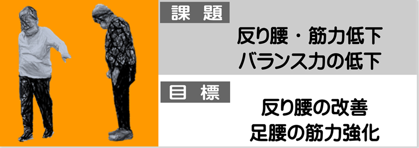踵重後期高齢者で反り腰と猫背の姿勢のために、歩行力の低下と筋力低下が著しくサルコペニアの進んだ状態