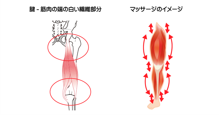 歩行トレーニングを効果的に行うためには、脚長差改善で体の土台となる下半身の安定が必要である